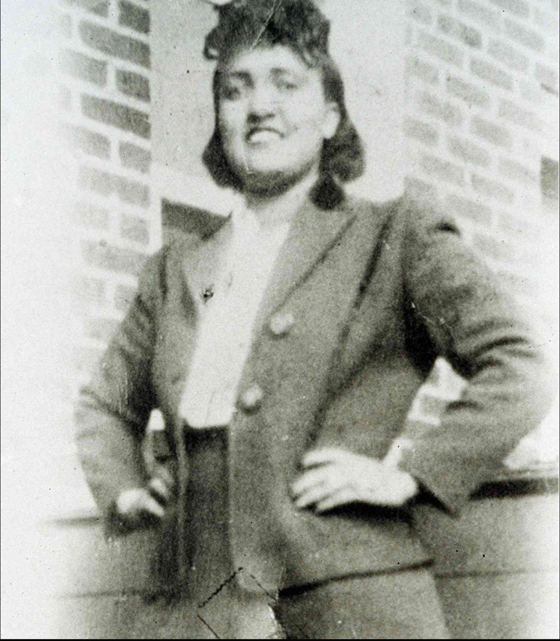 The Legacy of Henrietta Lacks: The Uncredited Pioneer of Modern Gynecology